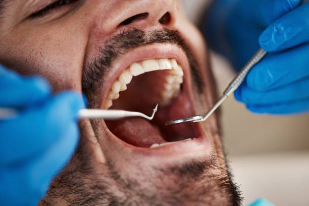 Best Emergency Dental Care for Broken or Chipped Teeth in East Moline, IL